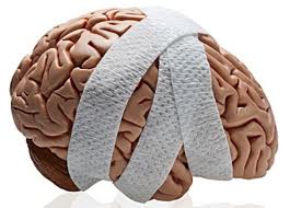 brain injury case
