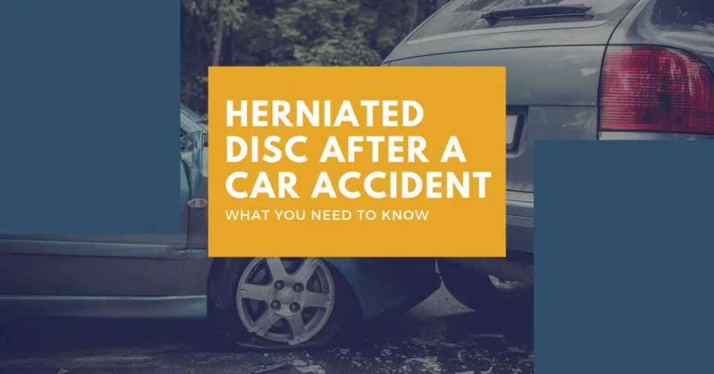 Herniated Disc After A Car Accident: What You Need To Know