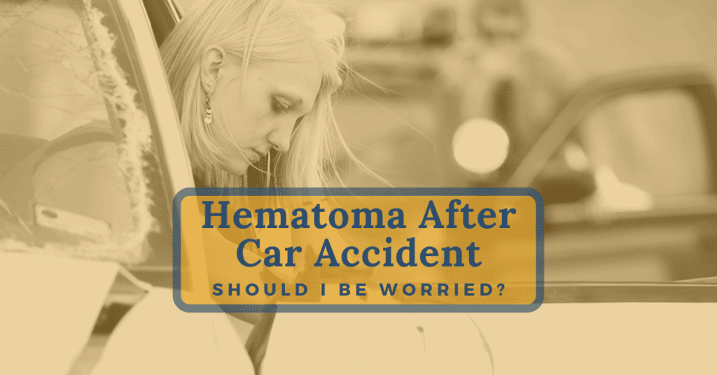 Hematoma After Car Accident: Should I Be Worried?