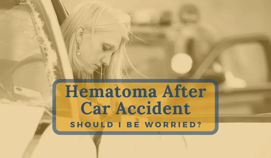 Hematoma After Car Accident: Should I Be Worried?
