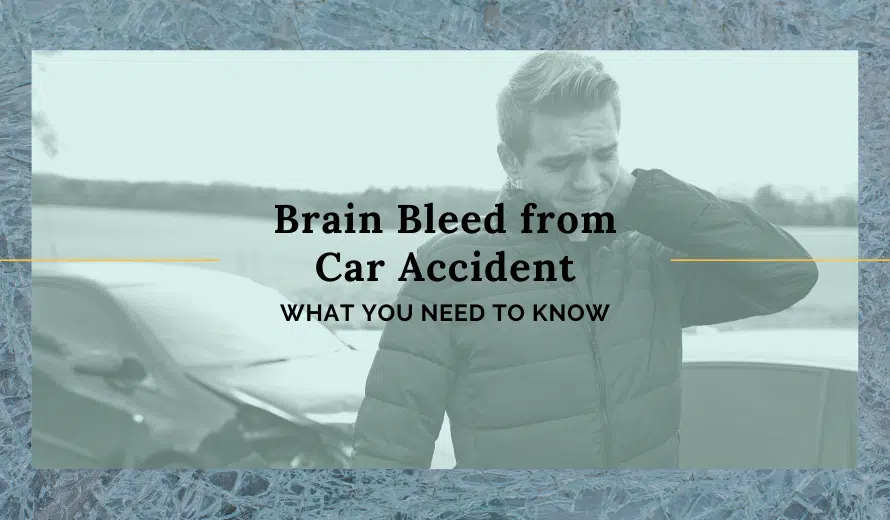 Brain Bleed From Car Accident: What You Need To Know