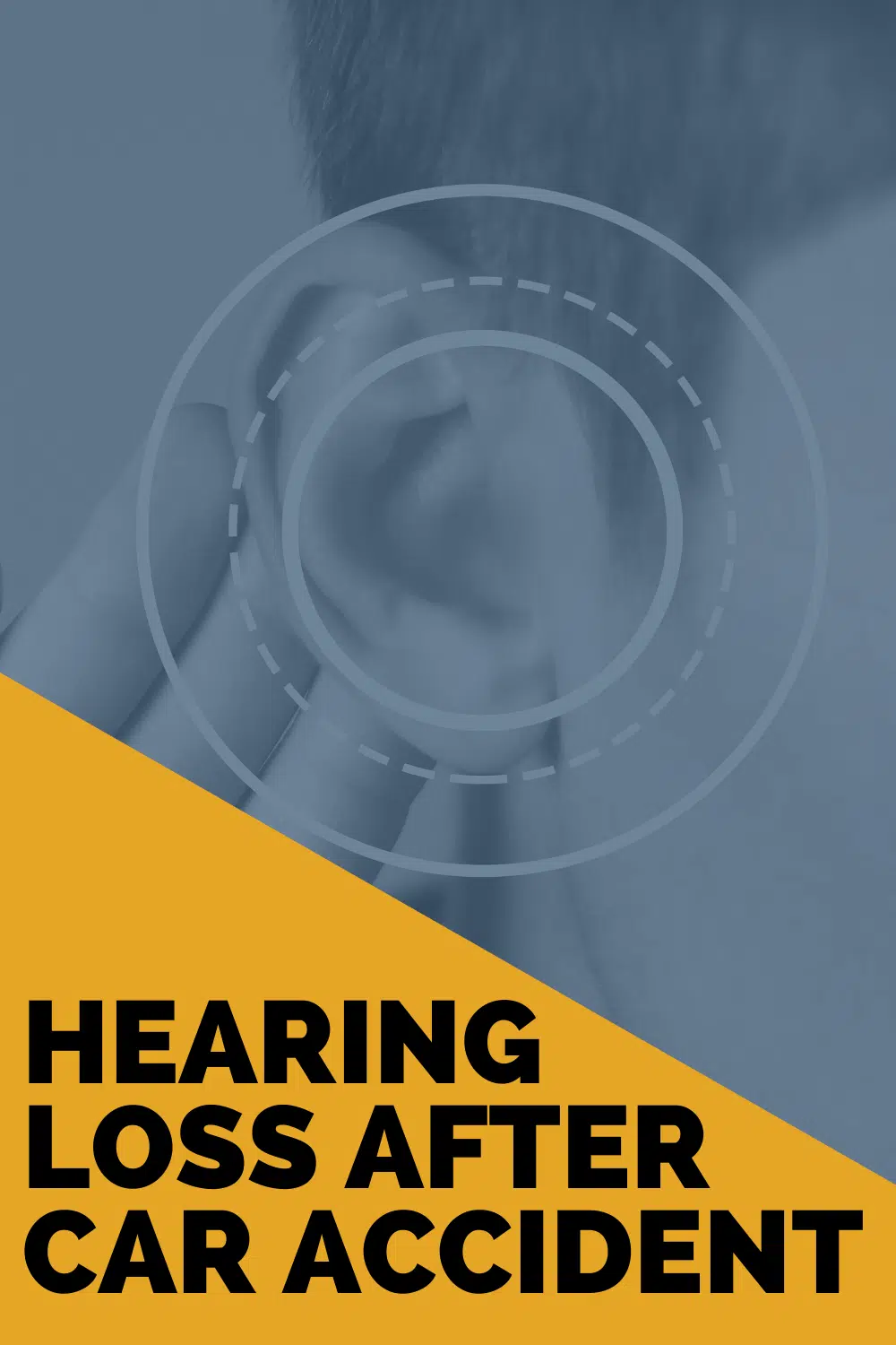 Hearing Loss After Car Accident: What You Need To Know