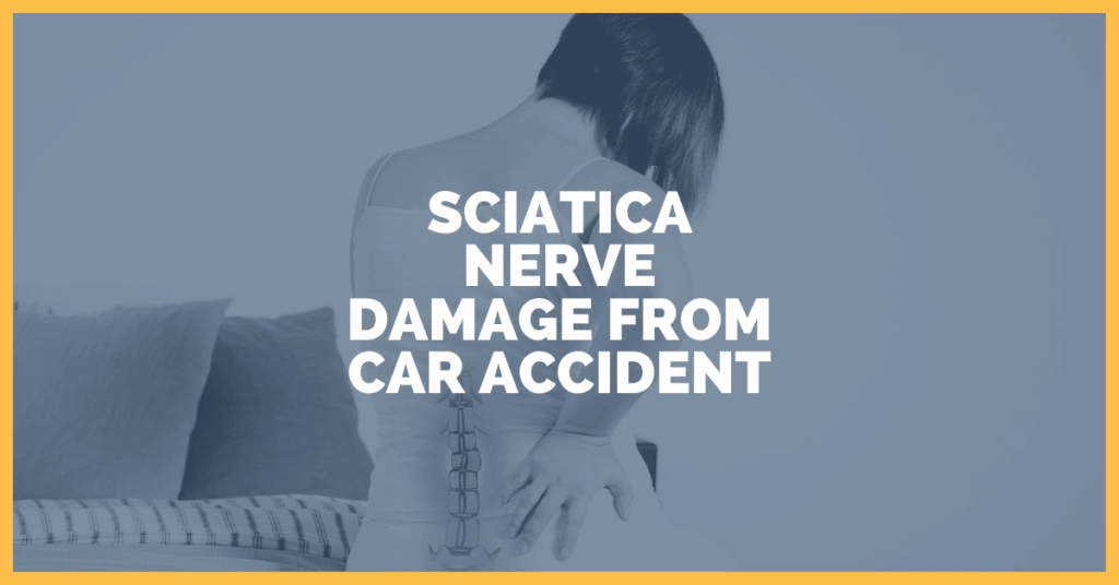 Sciatica Nerve Damage From Car Accident: Here's What To Know