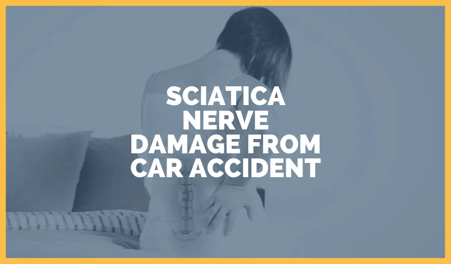 Sciatica Nerve Damage From Car Accident: Here's What To Know
