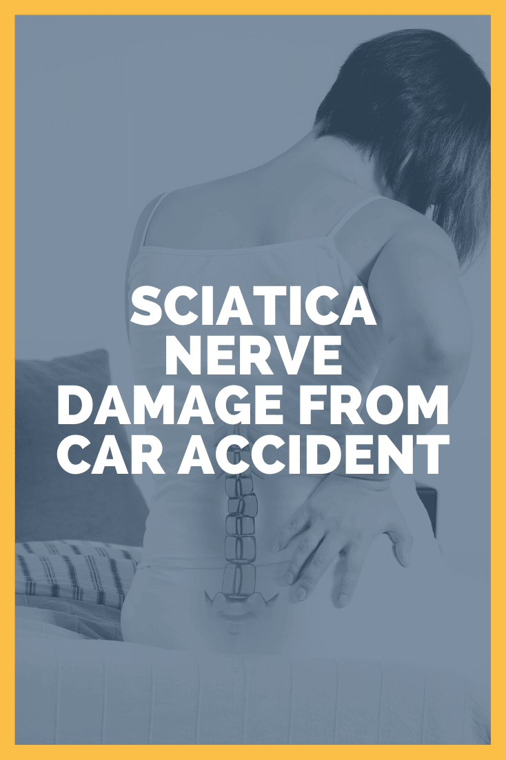 Sciatica Nerve Damage From Car Accident: Here\'s What To Know