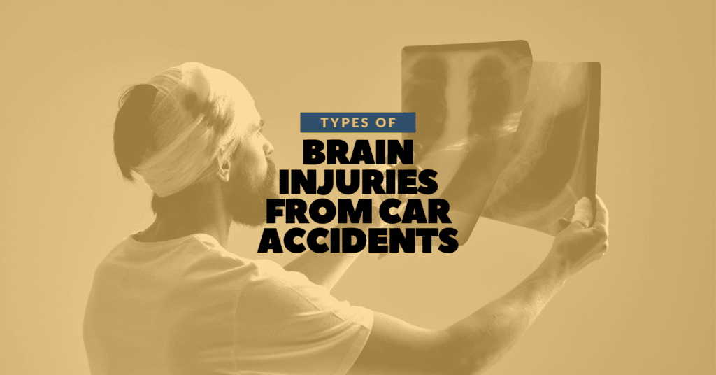 Types of Brain Injuries from Car Accidents