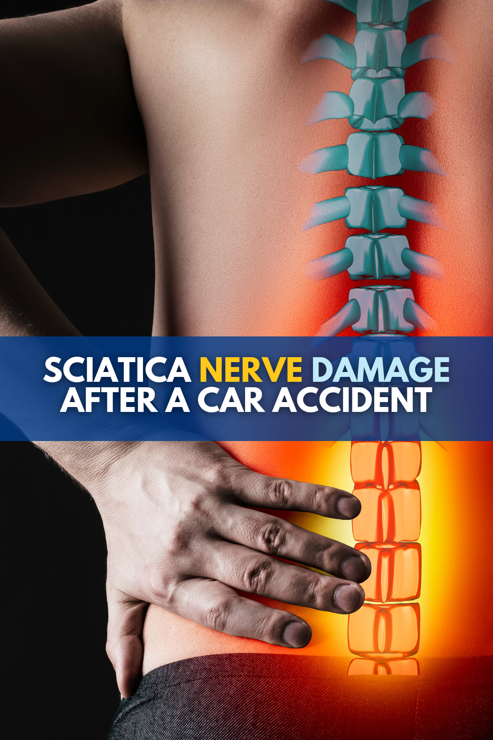 Sciatica Nerve Damage From Car Accident: Here\'s What To Know