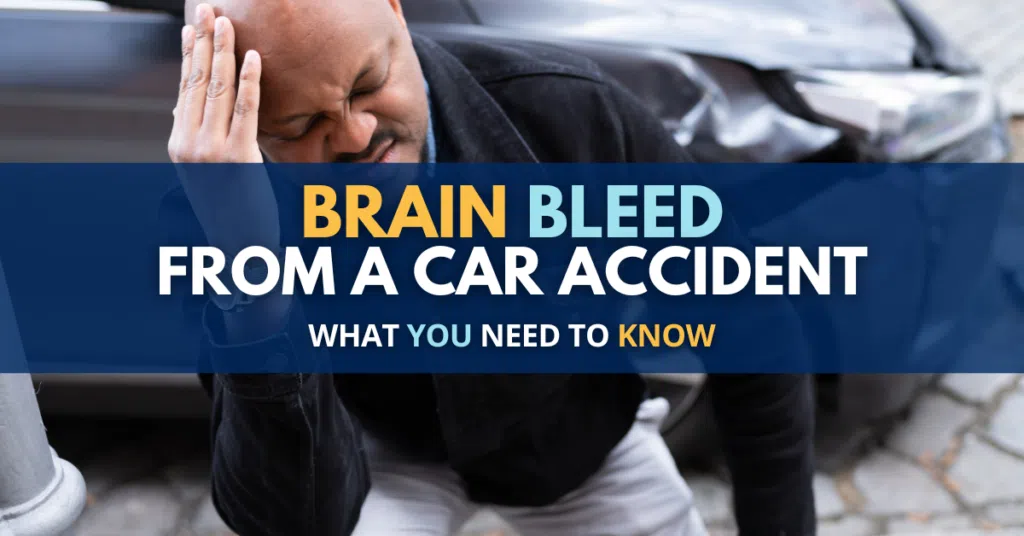 Brain Bleed From Car Accident: What You Need To Know
