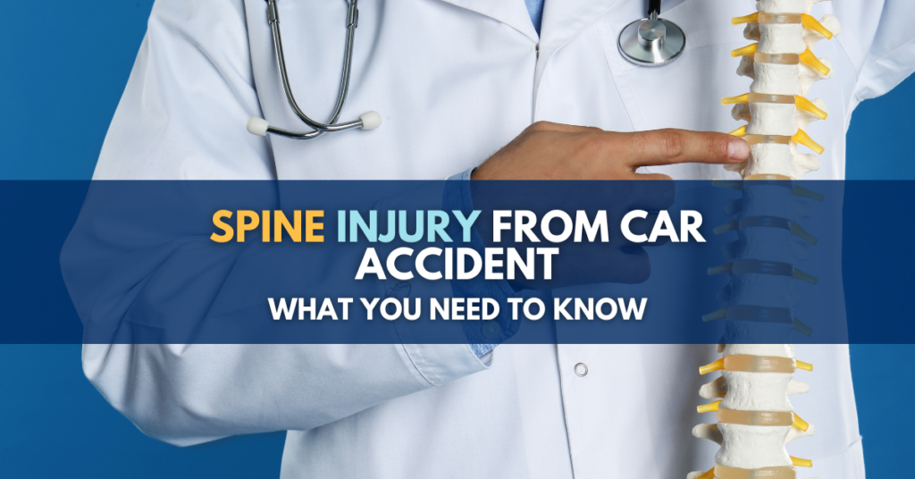 Spine Injury From Car Accident: What you need to know 