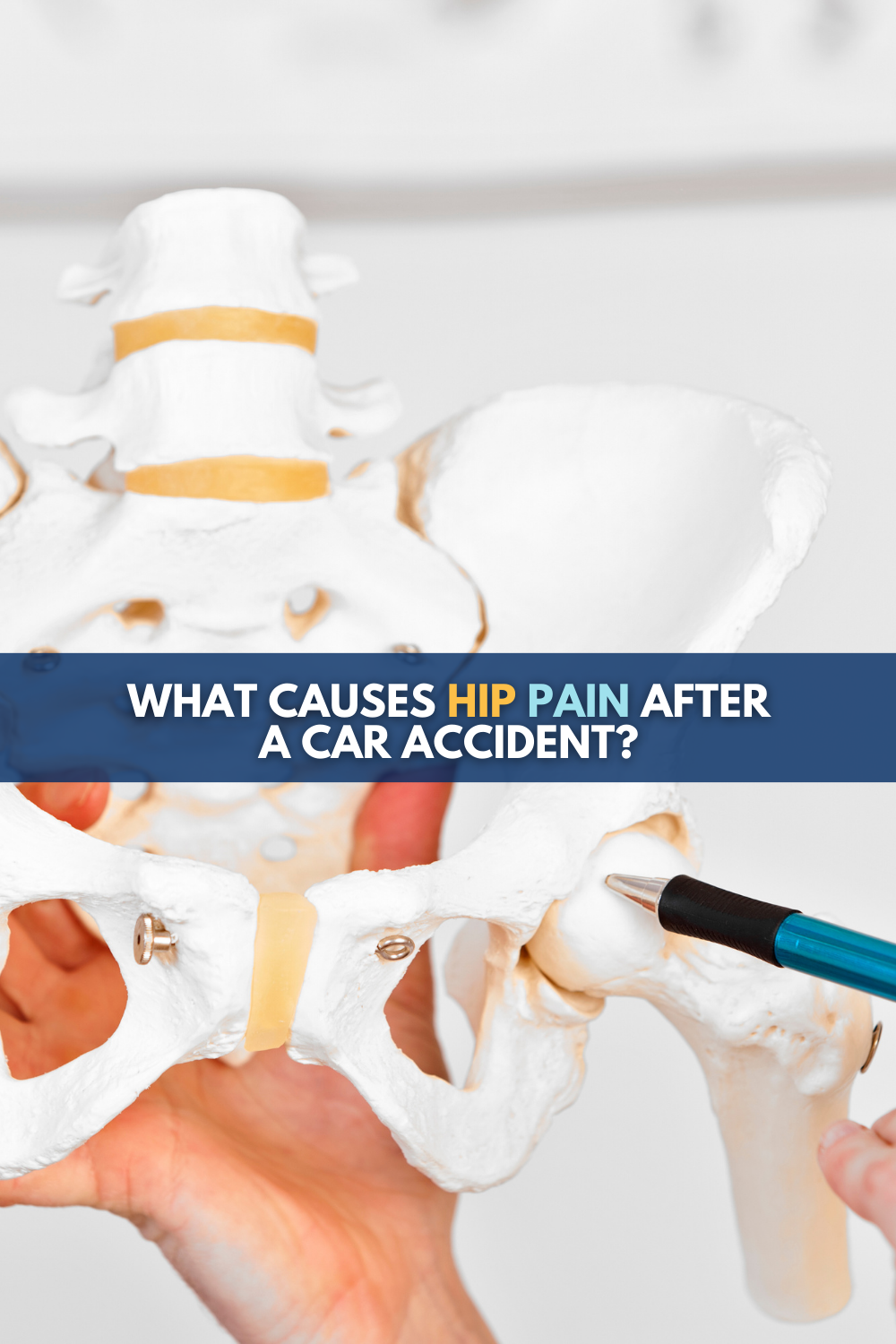 Hip Pain After Car Accident: Causes and What To Do