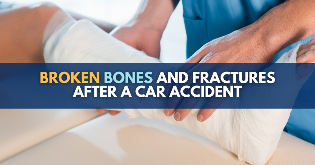 Broken bones and fractures after a car accident