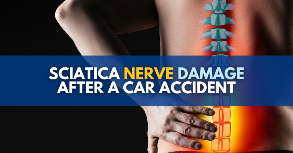 Sciatica nerve damage after a car accident