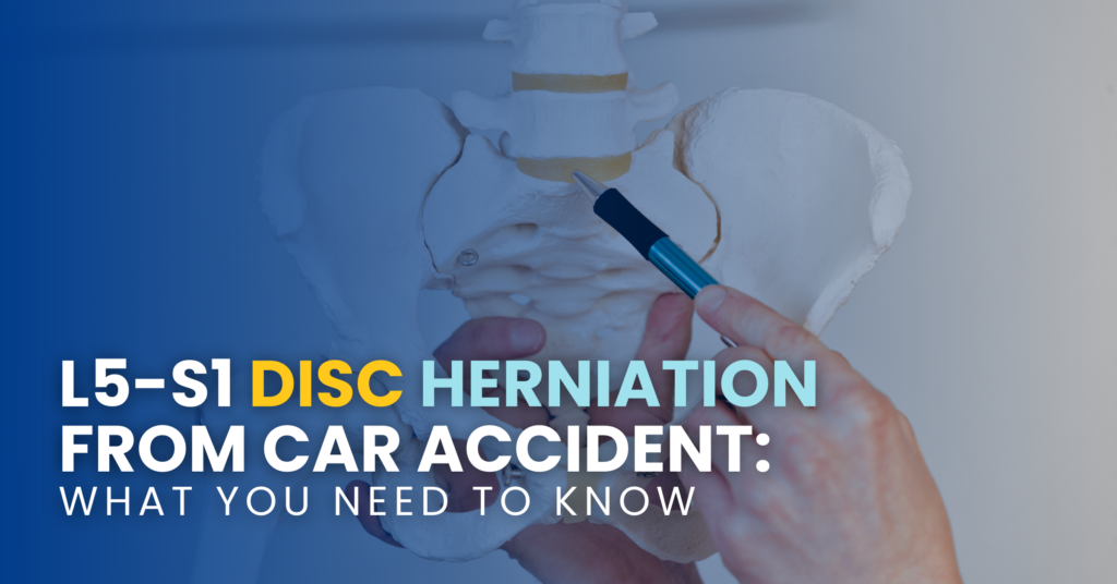 L5-S1 Disc Herniation From Car Accident: What You Need To Know