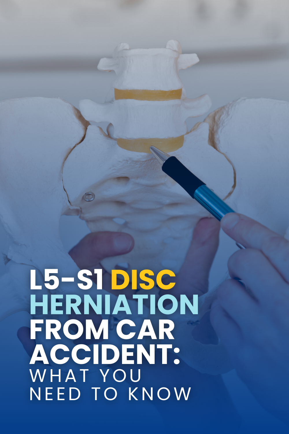 L5-S1 Disc Herniation From Car Accident: What You Need To Know