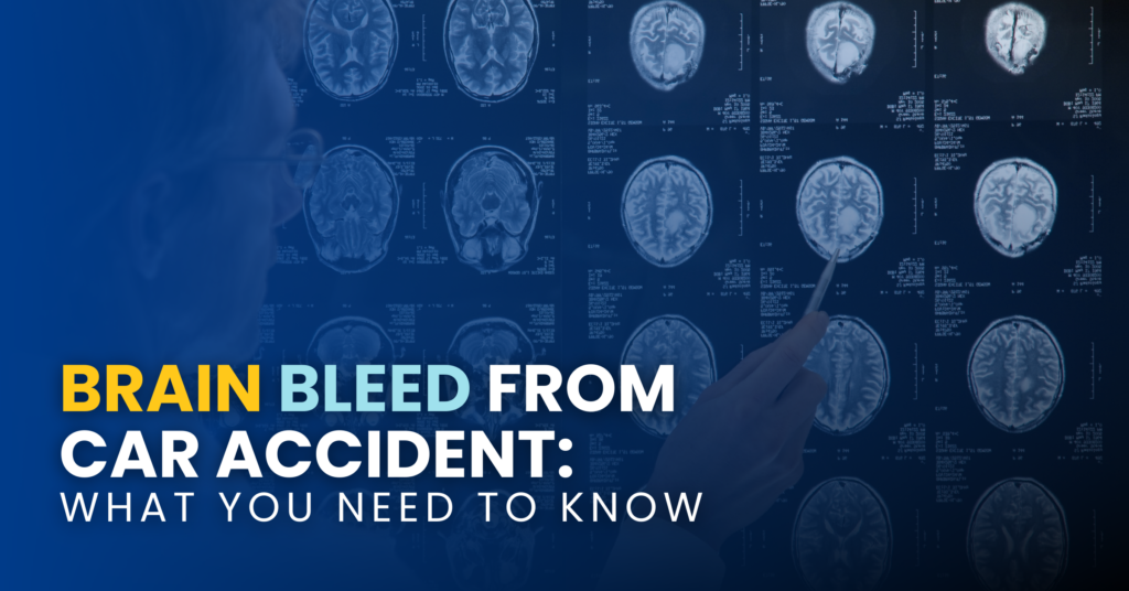 Brain Bleed From Car Accident: What You Need To Know