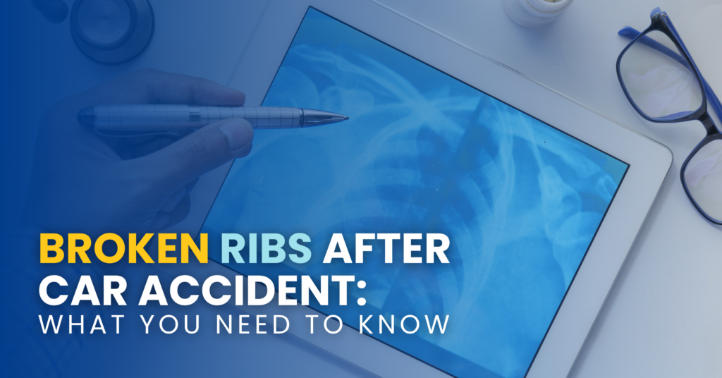 Broken Ribs After Car Accident: What You Need To Know